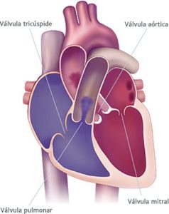 Diagram of heart with heart with valves - Aortic Valve Stenosis
