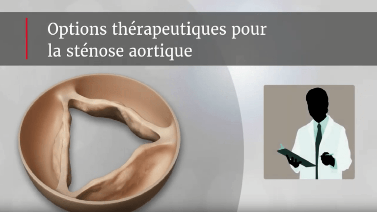 Options thérapeutiques pour la sténose aortique sévère