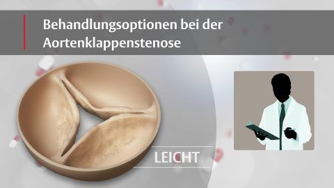 Treatment Options for AS