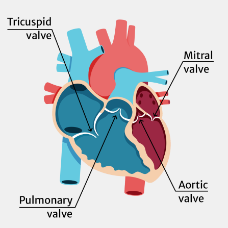 What is heart valve disease?